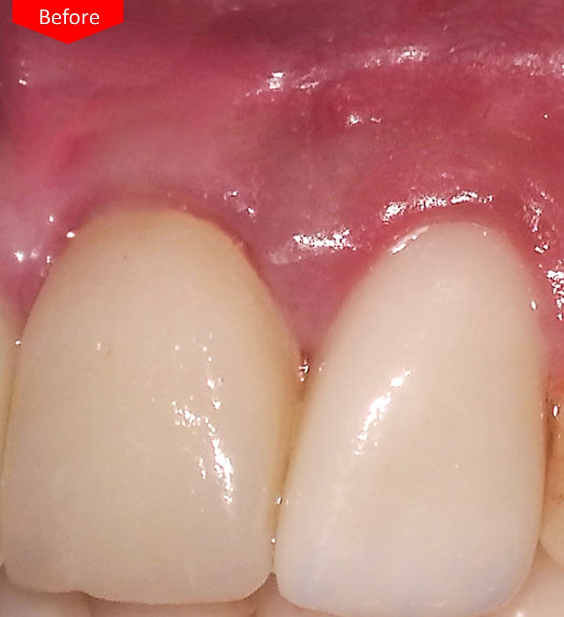 Smile Dental Clinic - Dr Uday Pawar