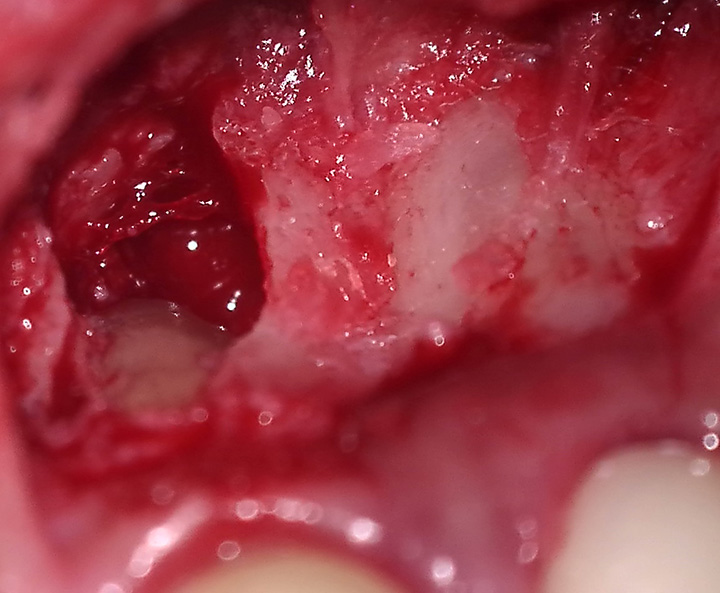 Smile Dental Clinic Kolhapur