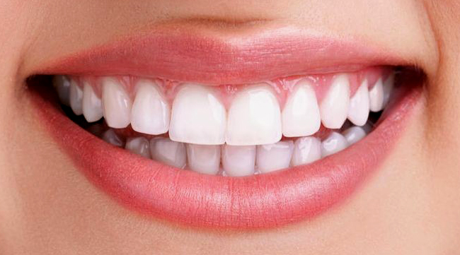 Teeth whitening